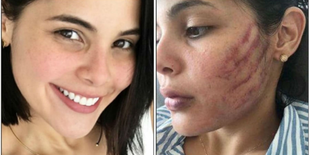 Instagram Mujer golpeada