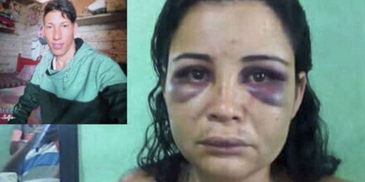 Lina Andrea Aguirre, la mujer golpeada salvajemente por su expareja Pedro Rojas.
