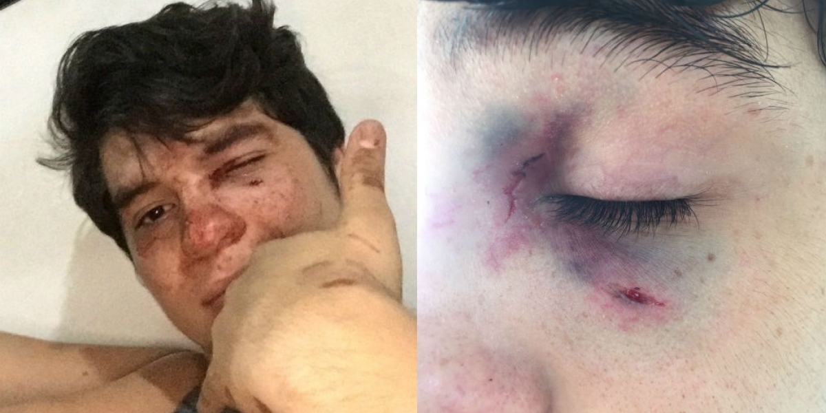 Cortesía Sebastián Noguera recibió golpes que le provocaron diferentes traumas.
