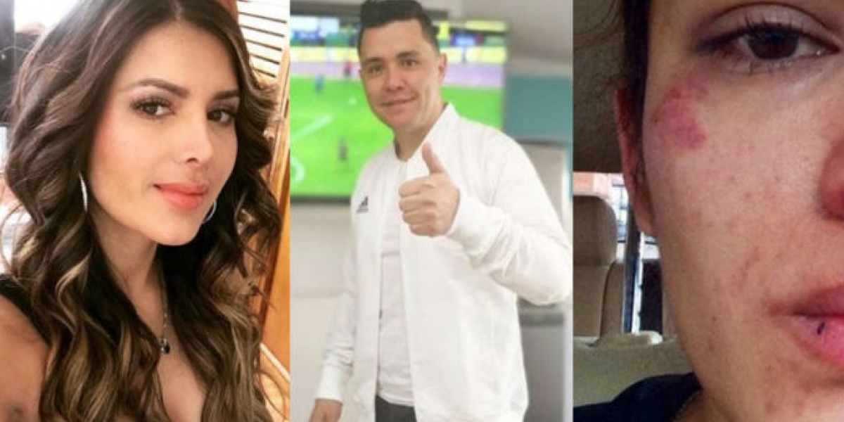 Colombian Juliana Daza y su expareja Ricardo Torres.