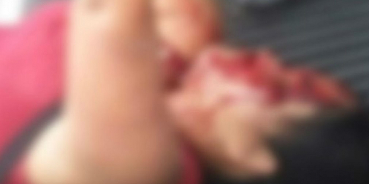 El Callejero Mujer agredida a puñal por su pareja.
