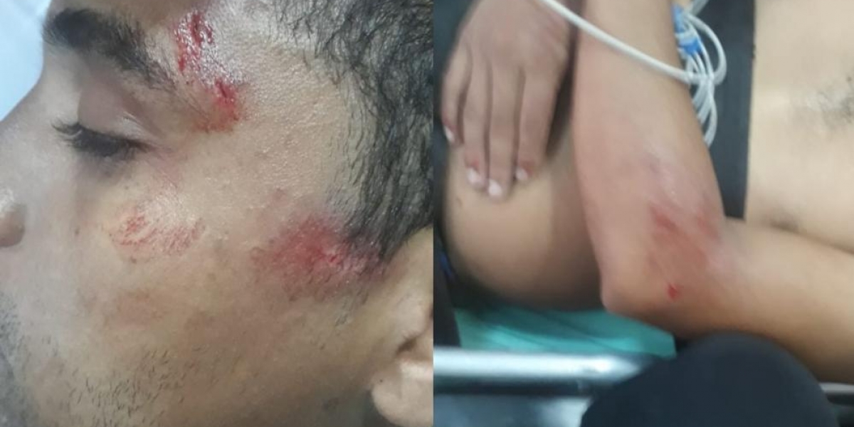 Zona Cero Estudiante golpeado