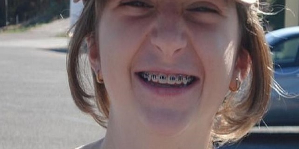 Daily Mail Cambio drástico en apariencia física de chica por que recibió matoneo en su escuela