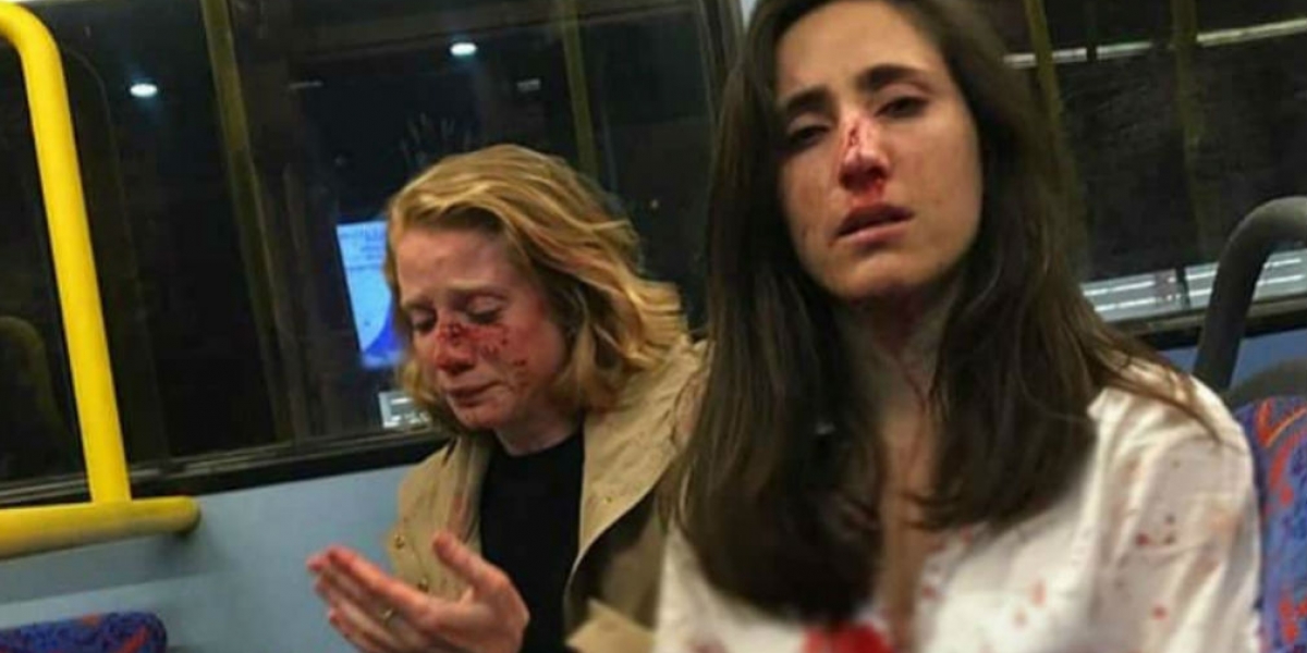 cortesía Paliza recibida por las mujeres en ataque homofóbico.