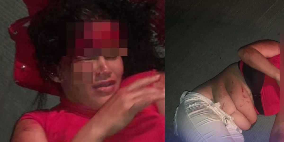 Mujer encontrada herida en plena vía rural.