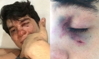 Sebastián Noguera recibió golpes que le provocaron diferentes traumas.