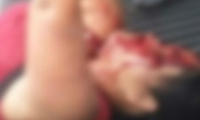 Mujer agredida a puñal por su pareja.