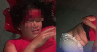 Mujer encontrada herida en plena vía rural.
