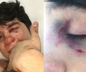 Sebastián Noguera recibió golpes que le provocaron diferentes traumas.