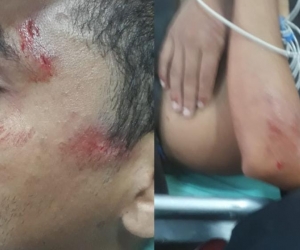 Estudiante golpeado