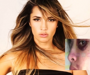 Actriz denuncia que su novio la golpeó en repetidas ocasiones