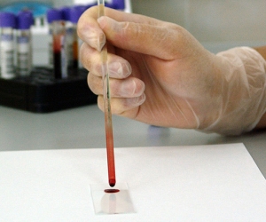 RT Imagen de referencia