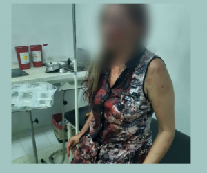 Archivo Elizabeth Montealegre Hernández fue la mujer brutalmente agredida.
