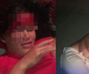 Mujer encontrada herida en plena vía rural.